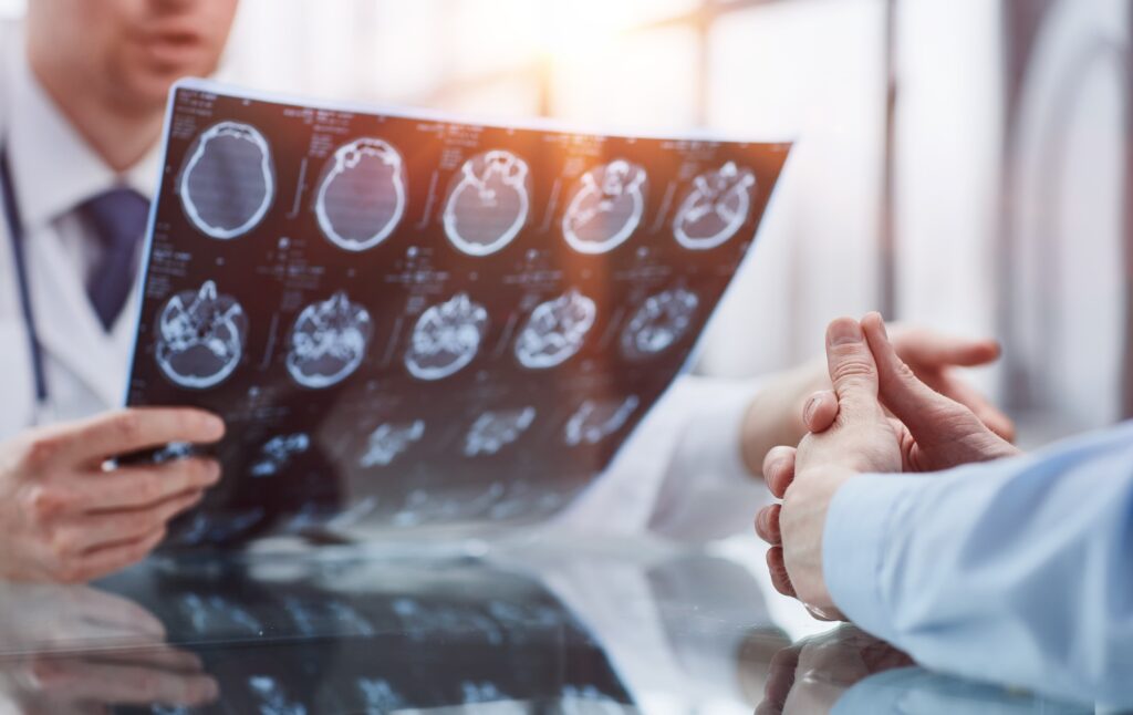 Doctor reviewing brain scan MRI results with patient during medical consultation.